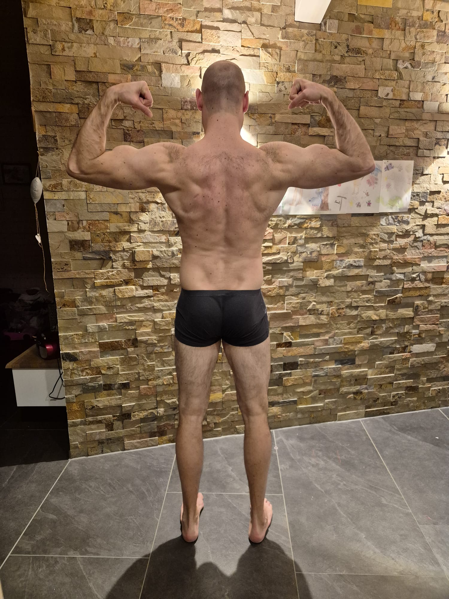 Michi Nachher Rücken