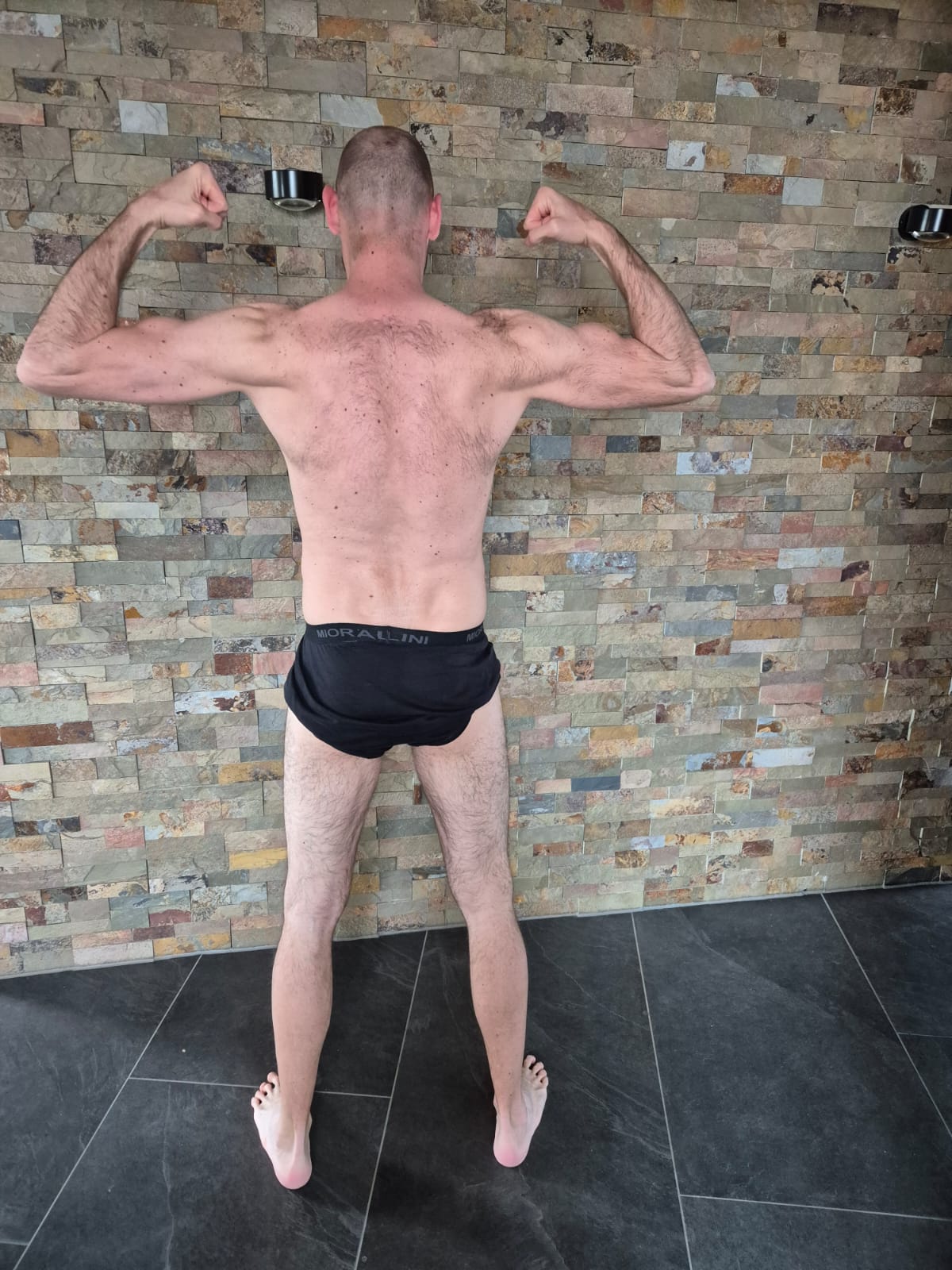 Michi Vorher Rücken